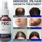 FEG Hair Growth Spray PLUS 50mL (Original)